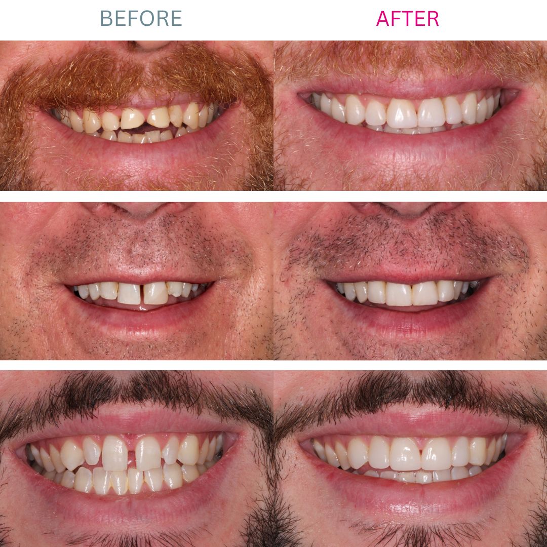 Micheals Before and After Photos